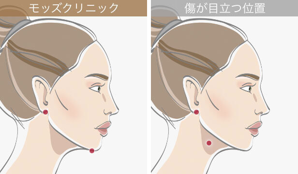 施術直後から動ける