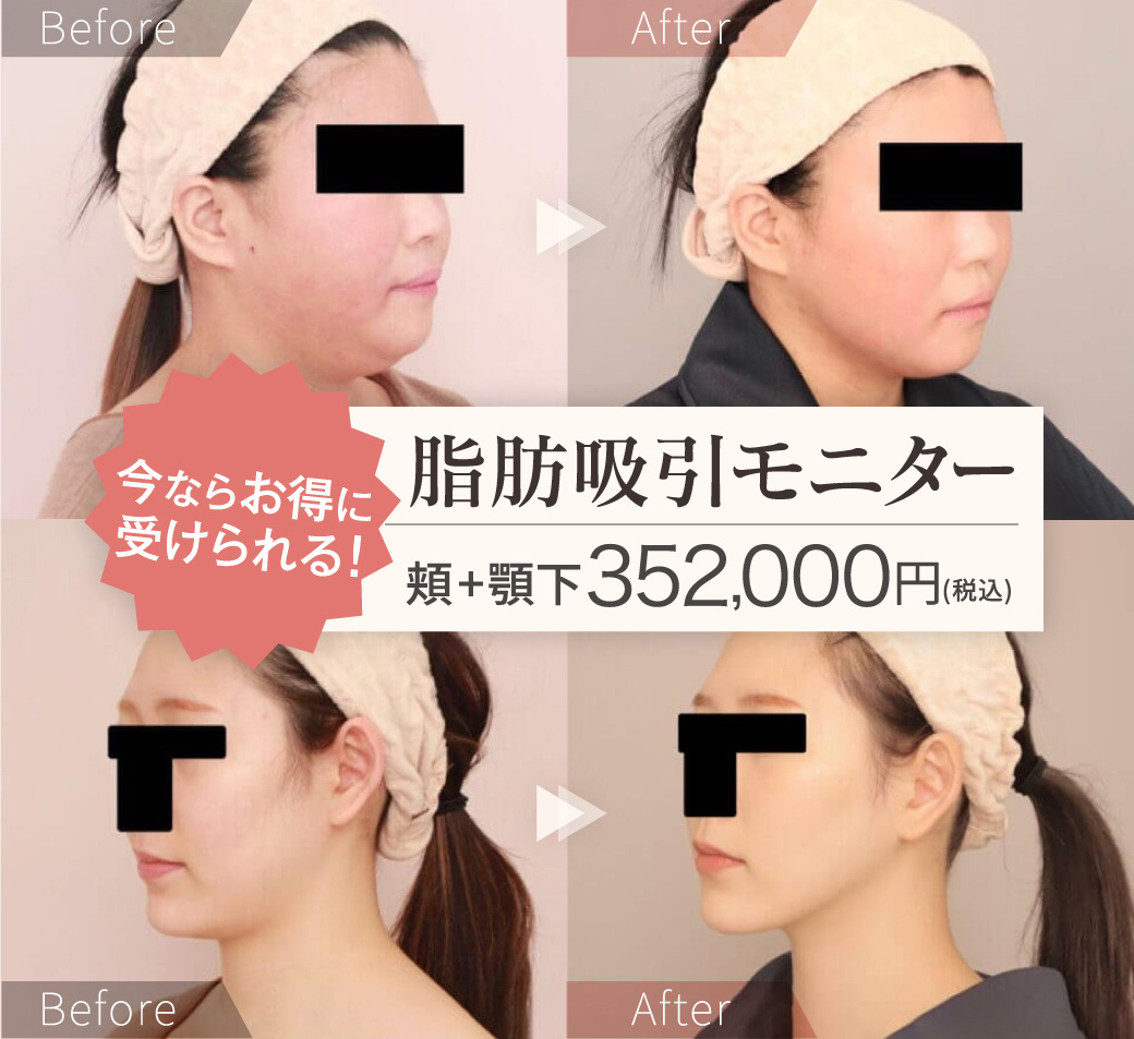 ビフォーアフター