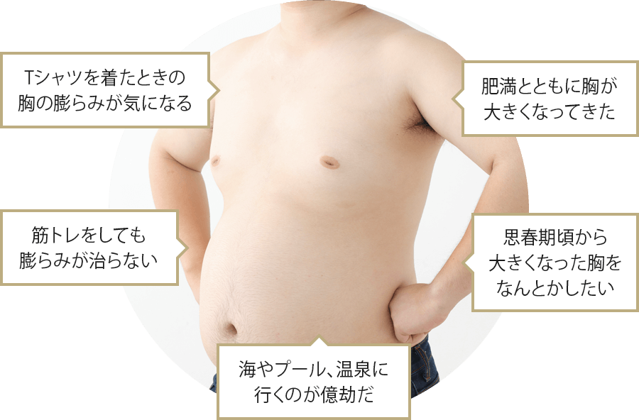Tシャツを着たときの胸の膨らみが気になる　筋トレをしても膨らみが治らない　海やプール、温泉に行くのが億劫だ　肥満とともに胸が大きくなった　思春期頃から大きくなった胸をなんとかしたい