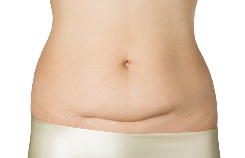 凸凹・段差ができる