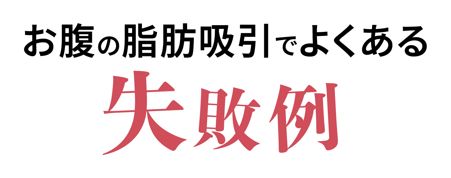 お腹の脂肪吸引でよくある失敗例