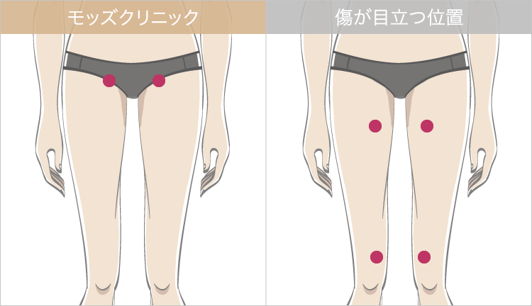 施術直後から動ける