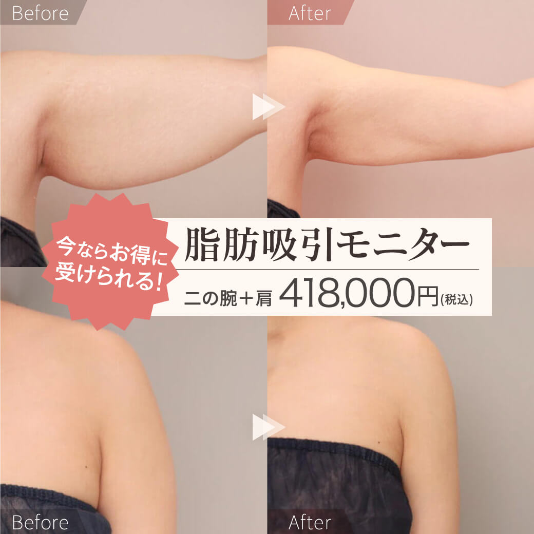 ビフォーアフター