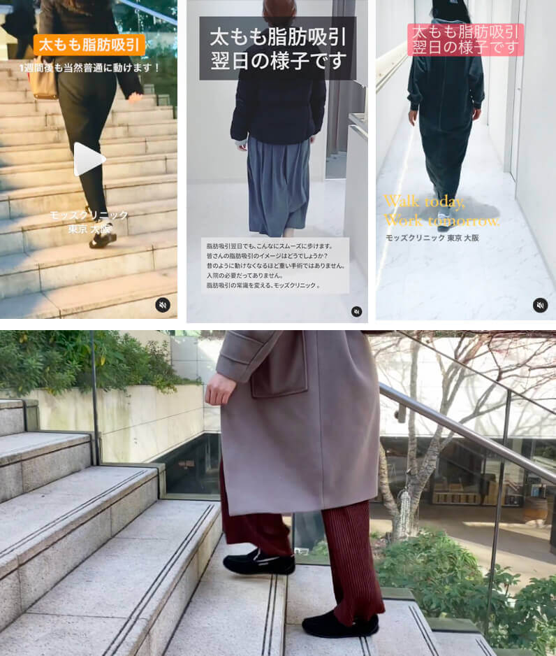 実際の施術直後の様子