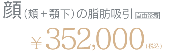 モニター料金